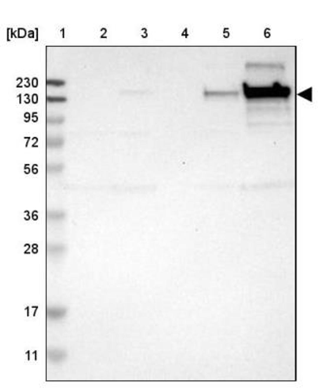 Immunohistochemistry: Collagen VI alpha 2 Antibody [NBP1-90951] - Lane 1: Marker [kDa] 230, 130, 95, 72, 56, 36, 28, 17, 11<br/>Lane 2: Human cell line RT-4<br/>Lane 3: Human cell line U-251MG sp<br/>Lane 4: Human plasma (IgG/HSA depleted)<br/>Lane 5: Human liver tissue<br/>Lane 6: Human tonsil tissue