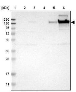 Immunohistochemistry: Collagen VI alpha 2 Antibody [NBP1-90951] - Lane 1: Marker [kDa] 230, 130, 95, 72, 56, 36, 28, 17, 11<br/>Lane 2: Human cell line RT-4<br/>Lane 3: Human cell line U-251MG sp<br/>Lane 4: Human plasma (IgG/HSA depleted)<br/>Lane 5: Human liver tissue<br/>Lane 6: Human tonsil tissue