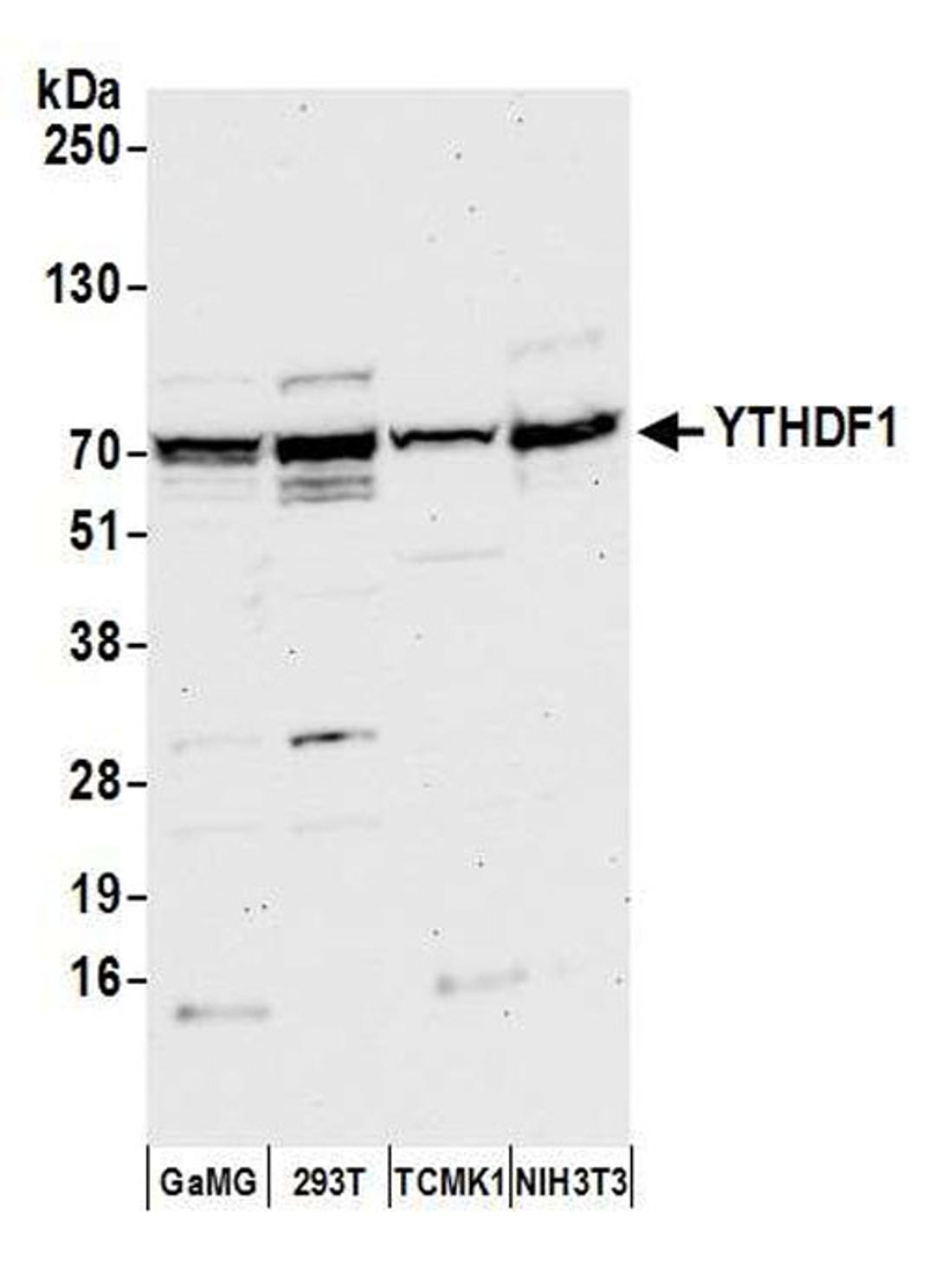 Detection of human and mouse YTHDF1 by WB.