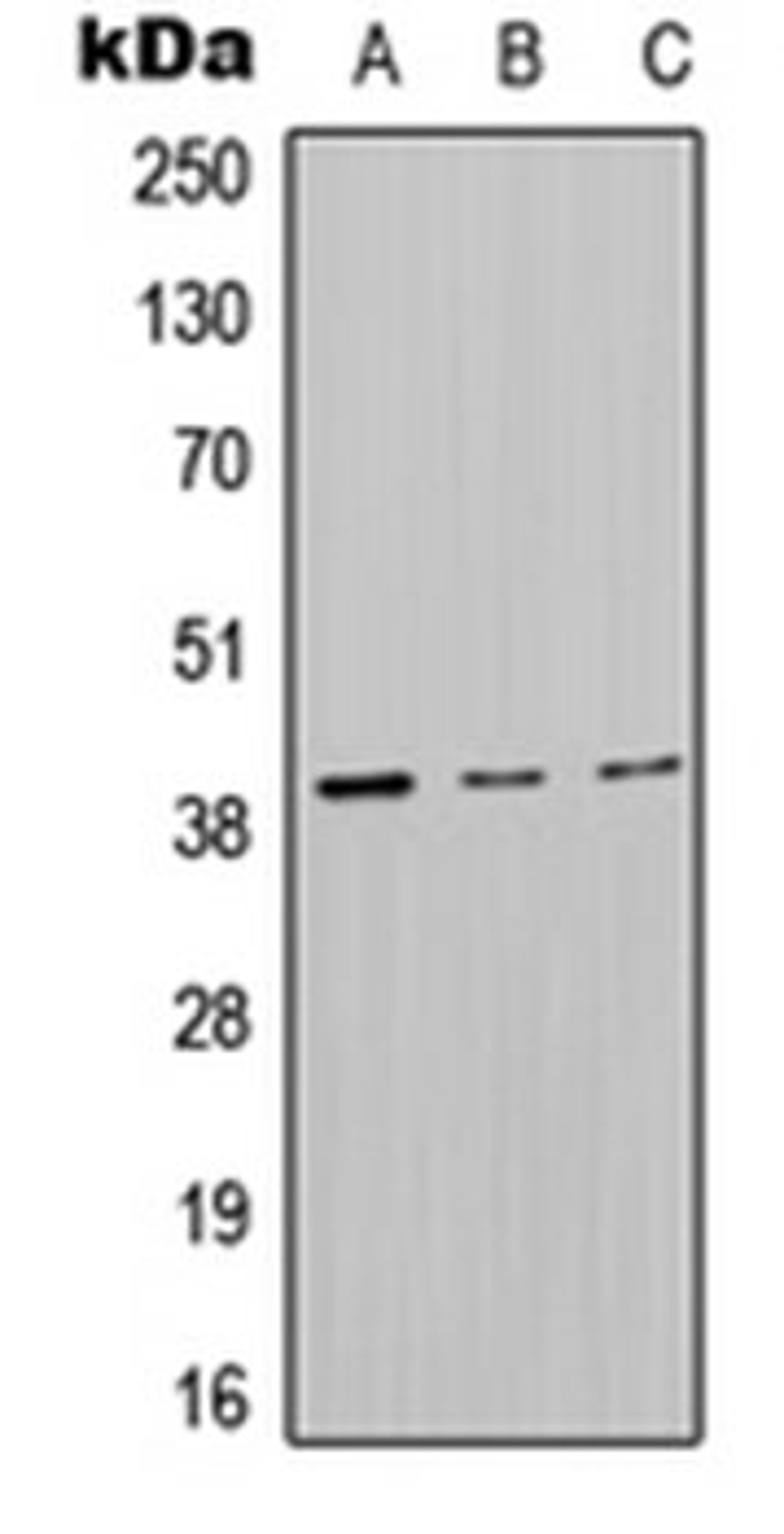 Western blot analysis of HepG2 (Lane 1), Raw264.7 (Lane 2), PC12 (Lane 3) whole cell lysates using MT-ND2 antibody