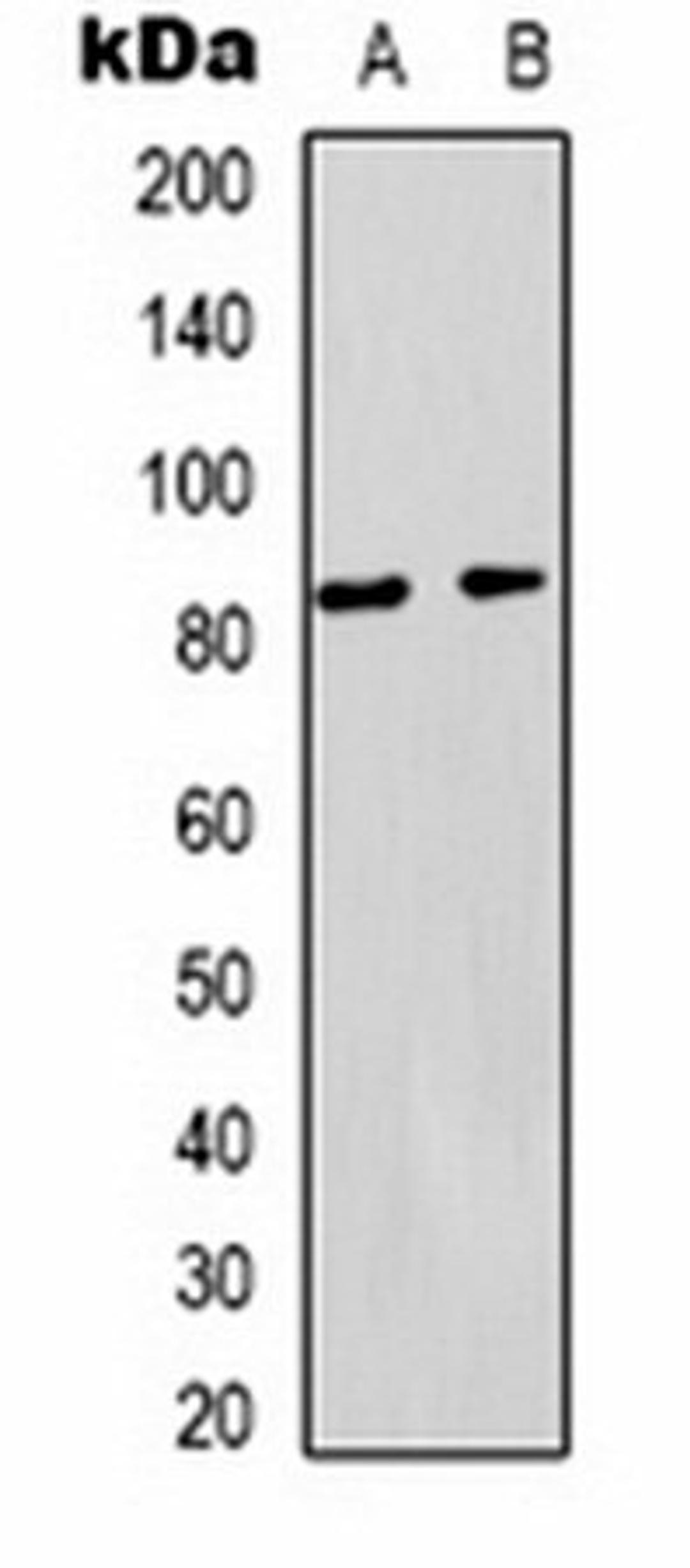 Western blot analysis of  HepG2 (Lane1), 293T (Lane2) whole cell lysates using PI3K p85 alpha antibody