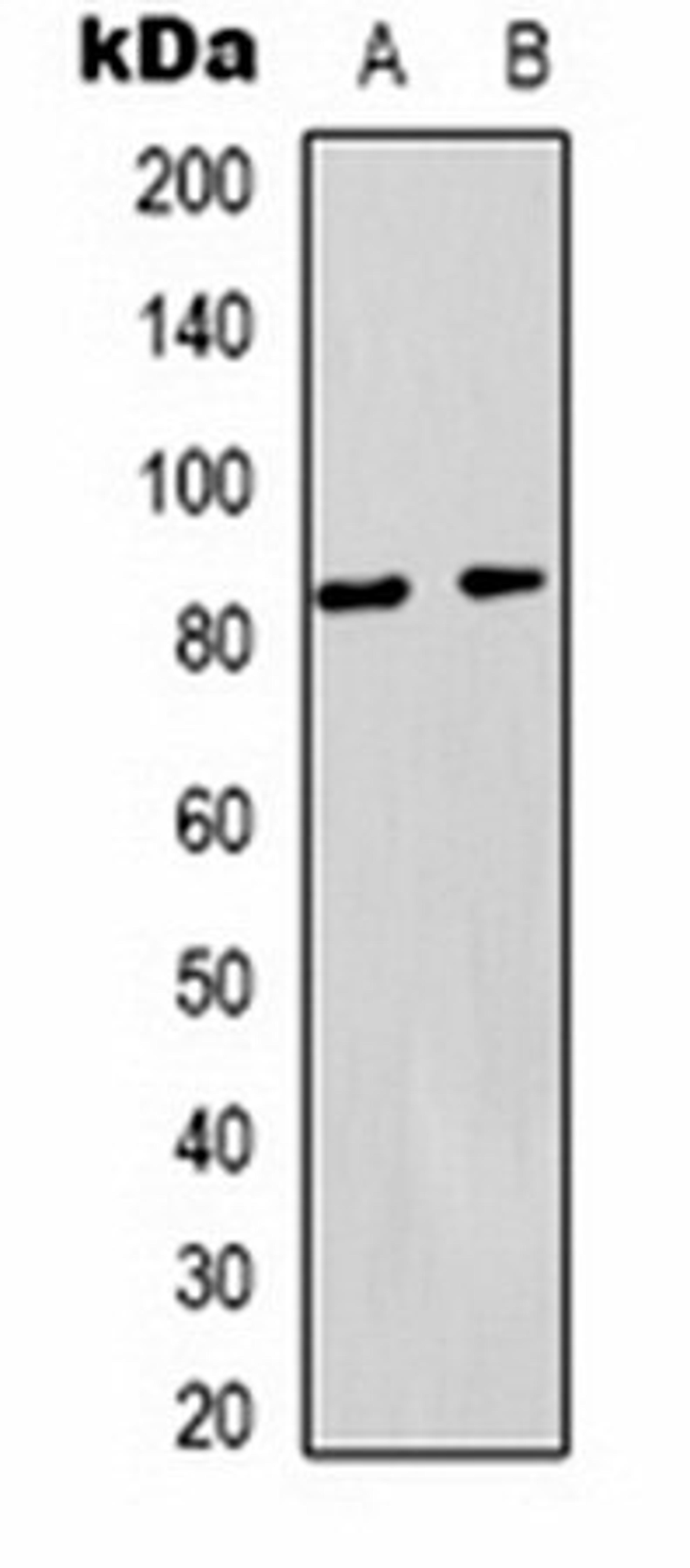 Western blot analysis of  HepG2 (Lane1), 293T (Lane2) whole cell lysates using PI3K p85 alpha antibody