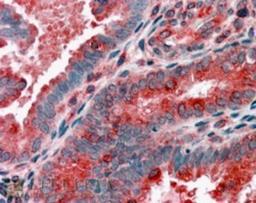 Immunohistochemistry: ACTR1B Antibody [NB100-1424] - (3.8ug/ml) staining of paraffin embedded Human Uterus. Steamed antigen retrieval with citrate buffer pH 6, AP-staining.