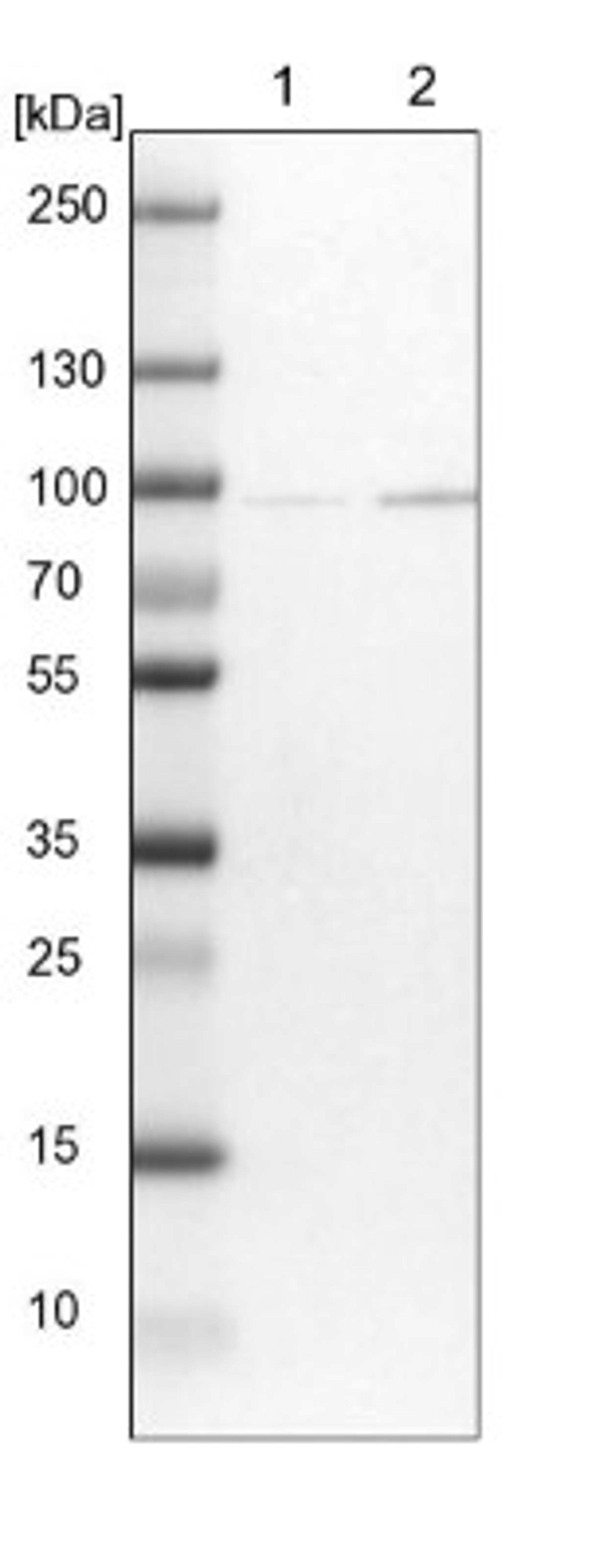 Western Blot: CNOT10 Antibody [NBP1-82278] - Lane 1: NIH-3T3 cell lysate (Mouse embryonic fibroblast cells)<br/>Lane 2: NBT-II cell lysate (Rat Wistar bladder tumour cells)