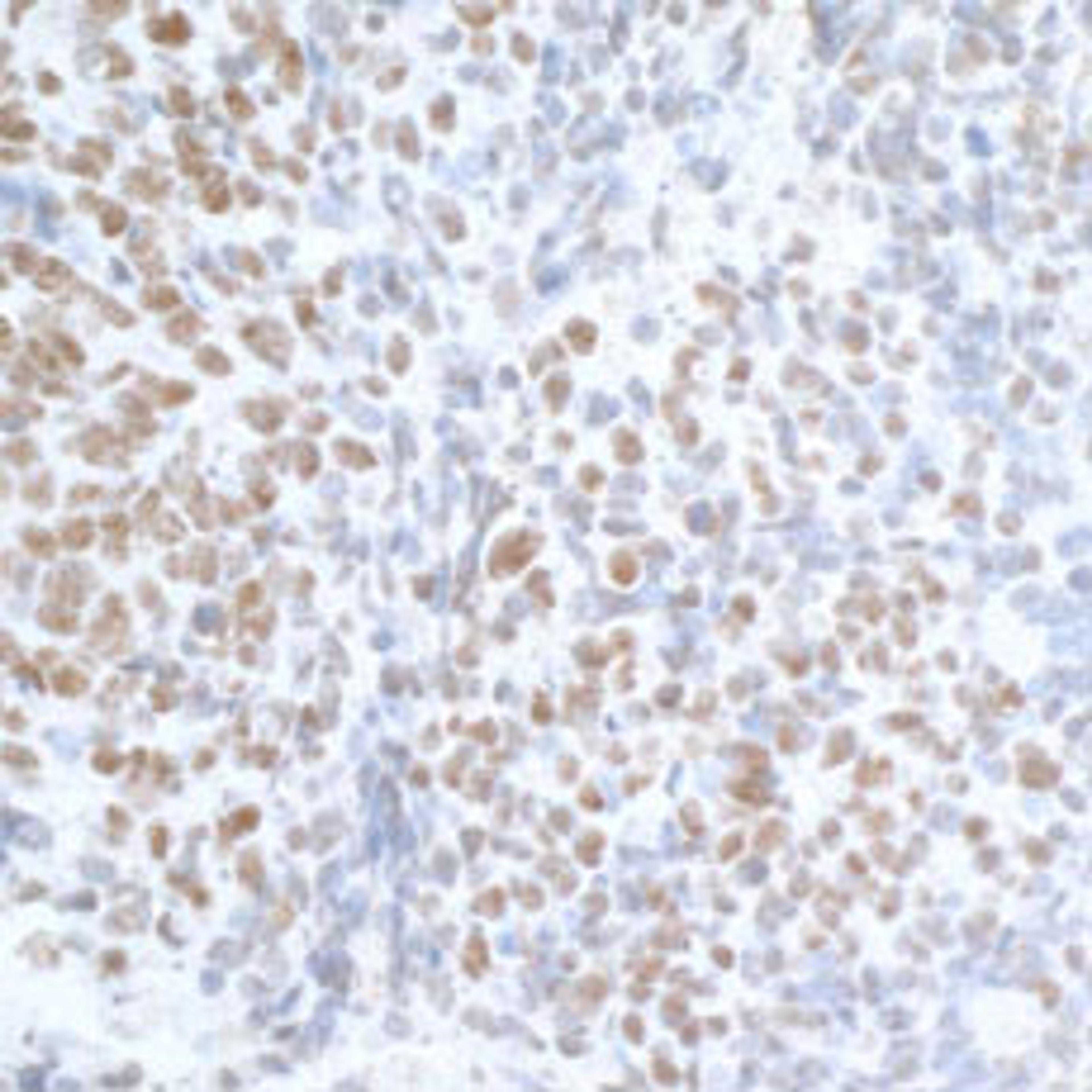 Detection of human U2AF35 by immunohistochemistry.