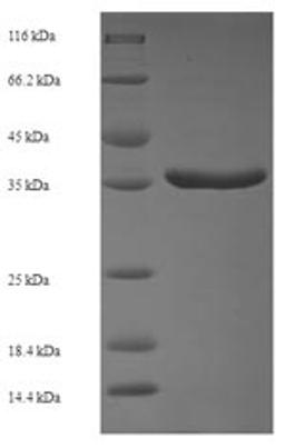 (Tris-Glycine gel) Discontinuous SDS-PAGE (reduced) with 5% enrichment gel and 15% separation gel.