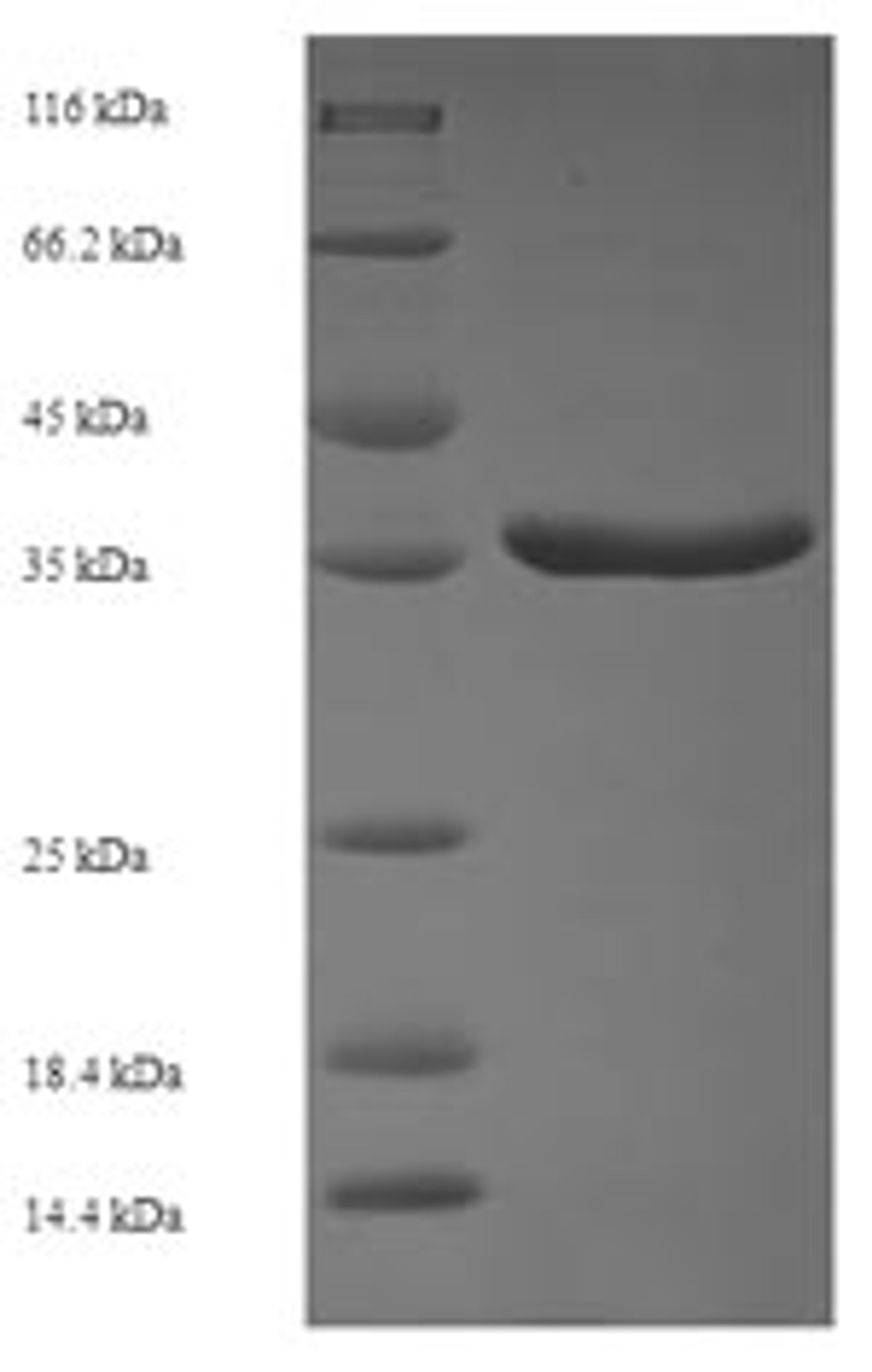 (Tris-Glycine gel) Discontinuous SDS-PAGE (reduced) with 5% enrichment gel and 15% separation gel.