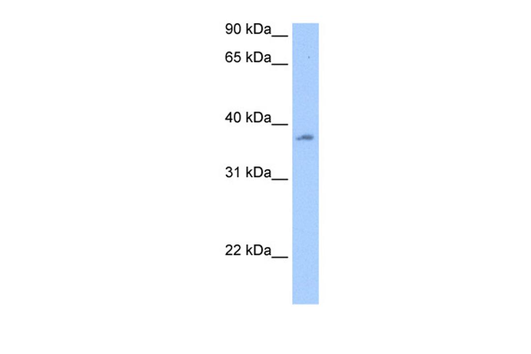 Antibody used in WB on Human Liver at 0.2-1 ug/ml.