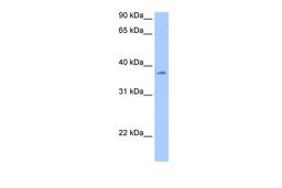 Antibody used in WB on Human Liver at 0.2-1 ug/ml.