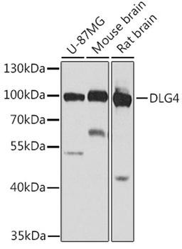 Western blot - DLG4 antibody (A7889)