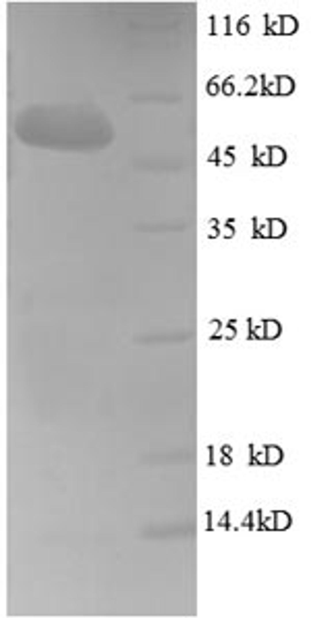 (Tris-Glycine gel) Discontinuous SDS-PAGE (reduced) with 5% enrichment gel and 15% separation gel.