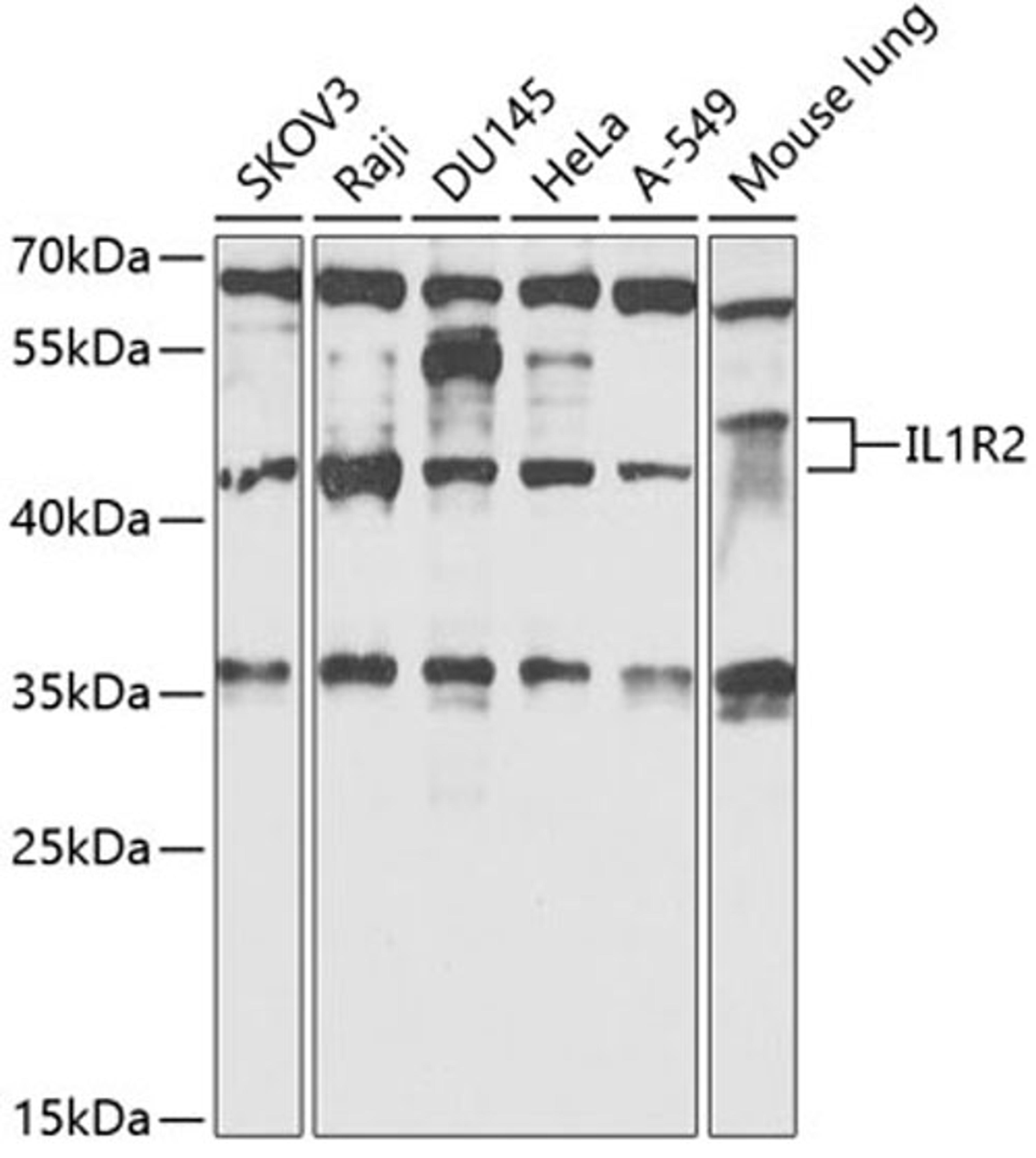 Western blot - IL1R2 antibody (A14072)