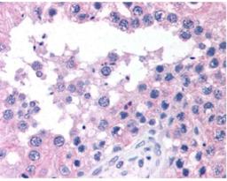 Immunohistochemistry: ATM Antibody [NB100-104] - Staining of Testis, Seminiferous Tubule.