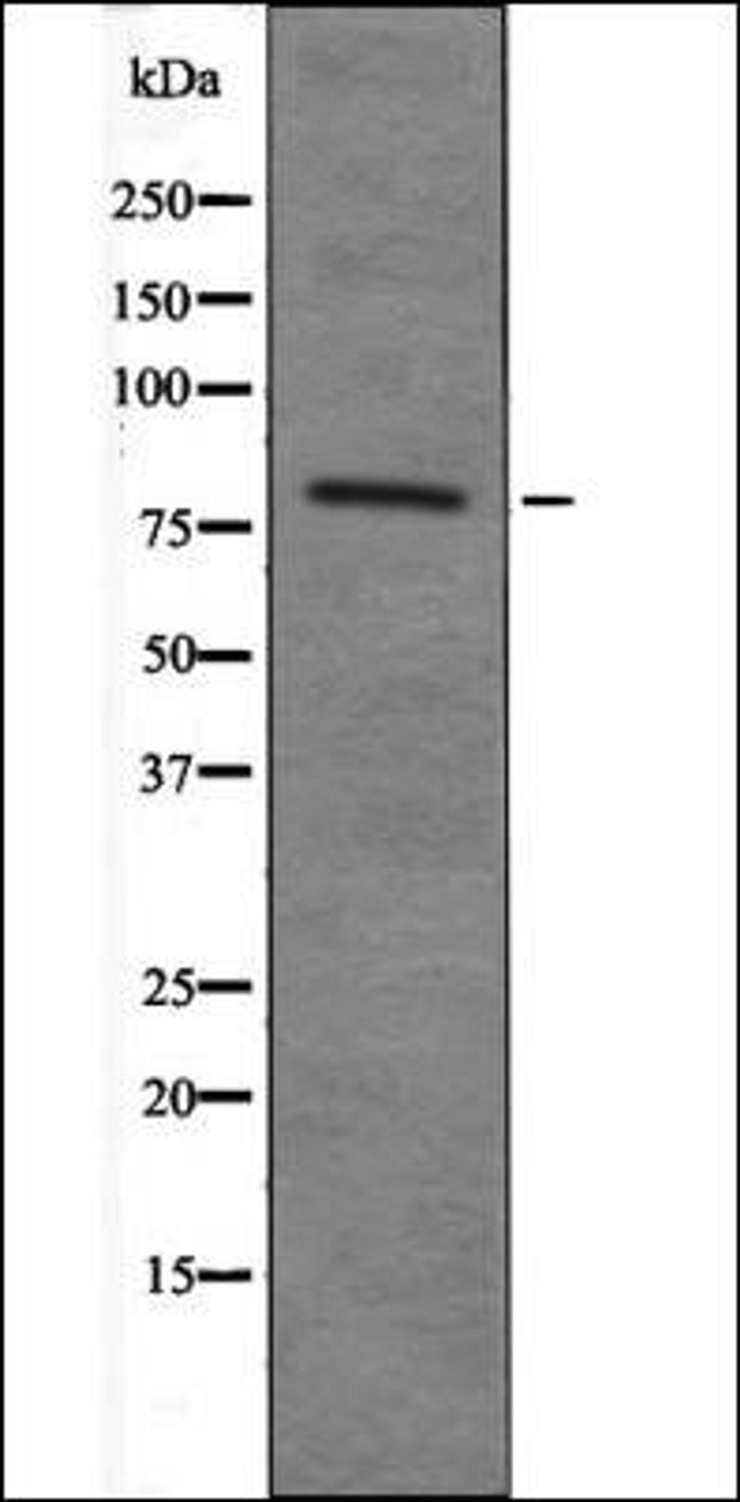 Western blot analysis of 293 whole cell lysates using MARK2 -Phospho-Thr596- antibody