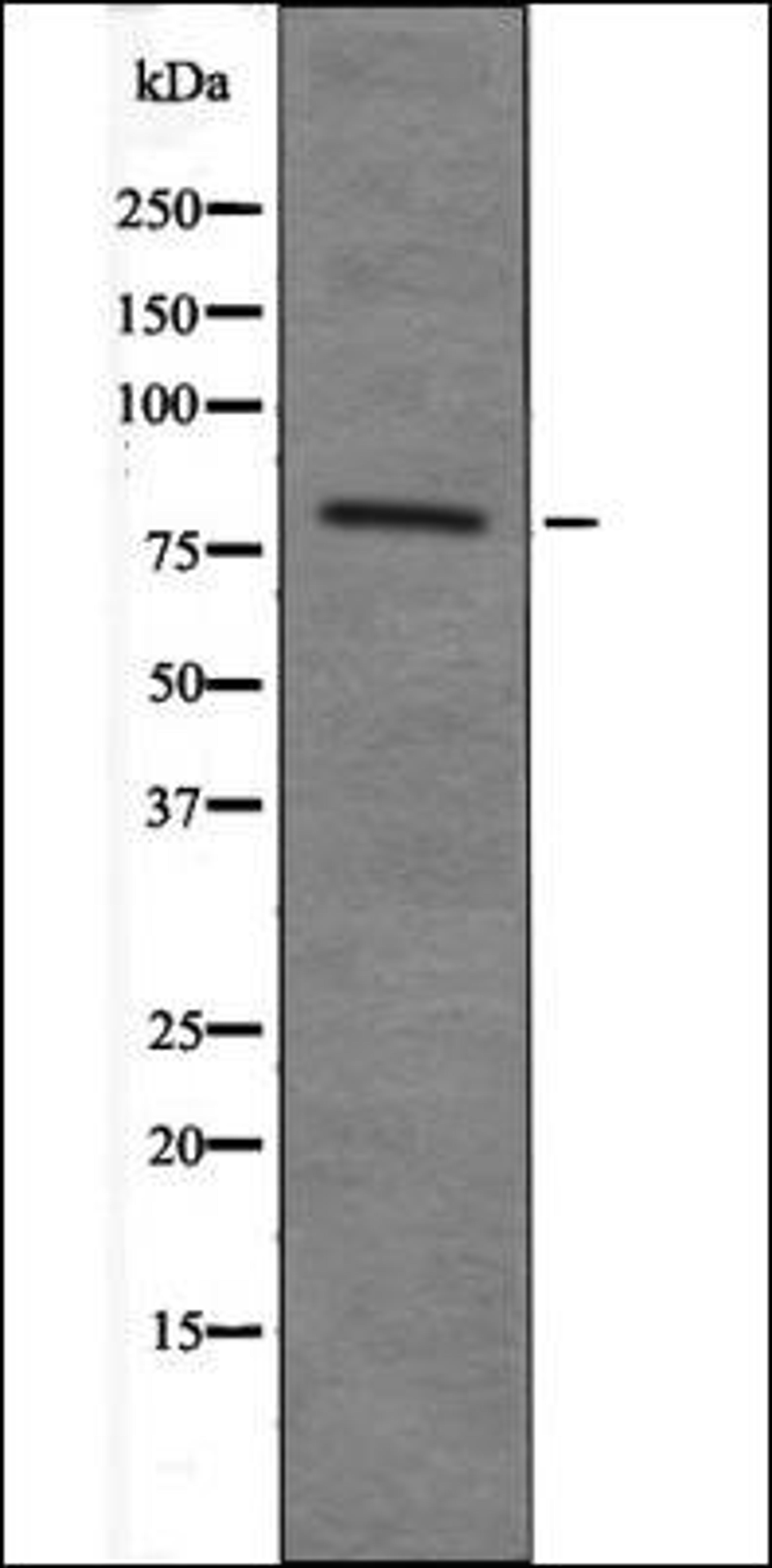 Western blot analysis of 293 whole cell lysates using MARK2 -Phospho-Thr596- antibody