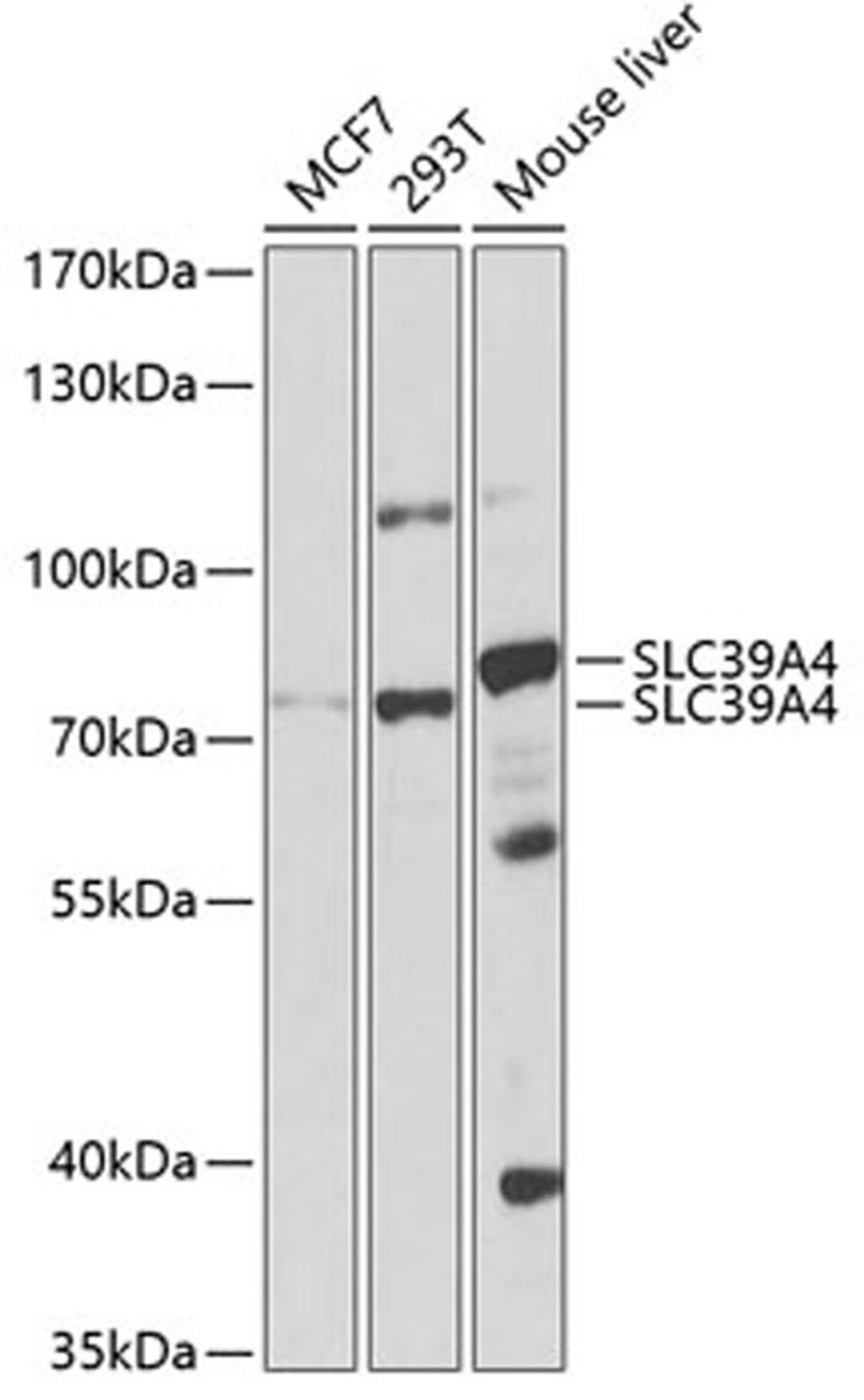 Western blot - SLC39A4 antibody (A3454)