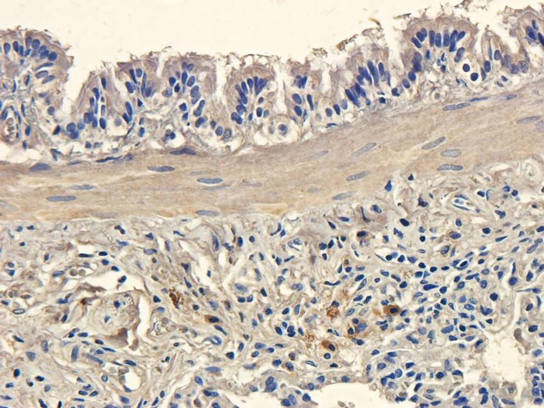 Immunohistochemical staining of rat lung tissue using IDO antibody (dilution of primary antibody - 2.5 ug/ml)