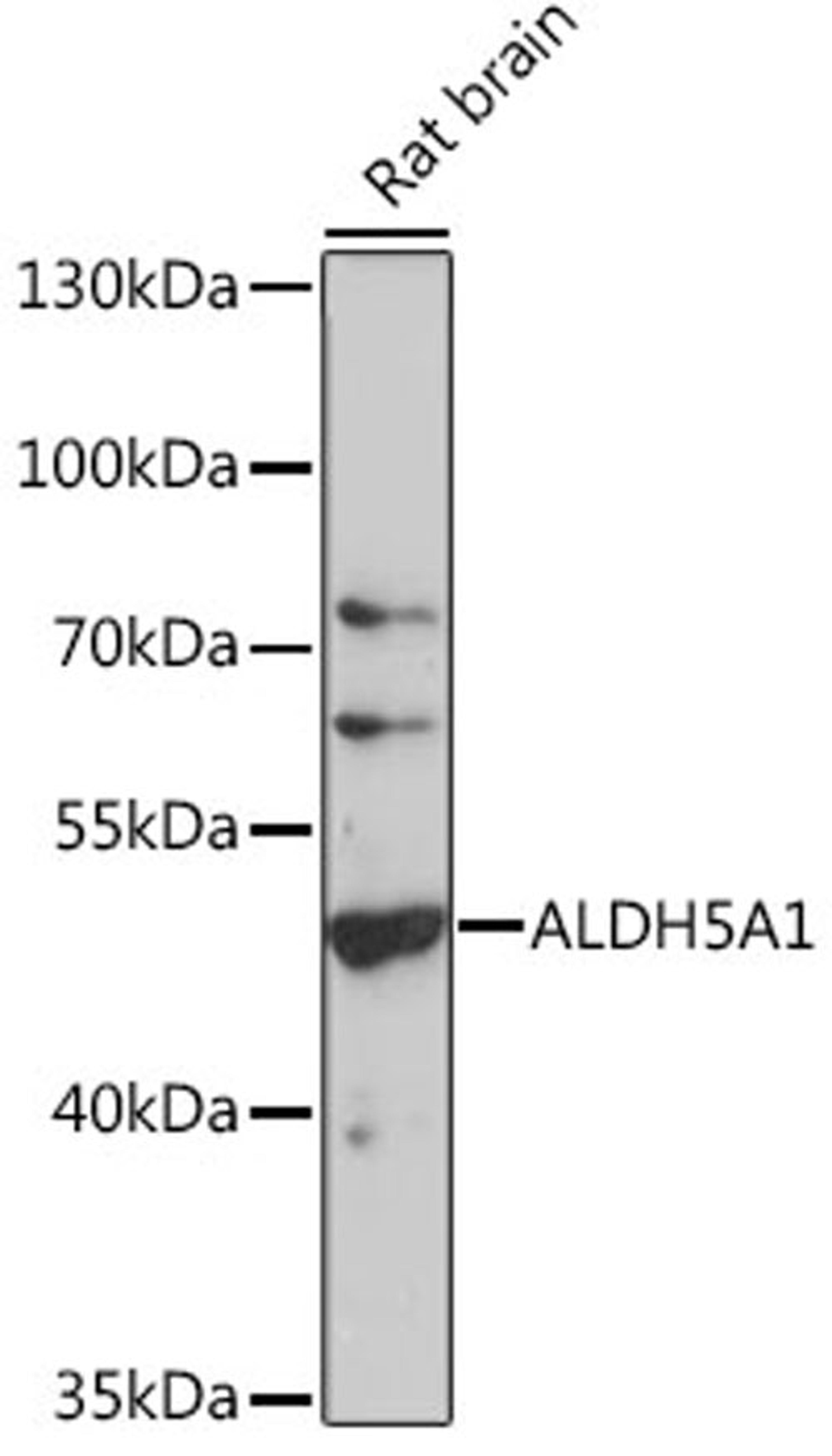 Western blot - ALDH5A1 antibody (A16074)