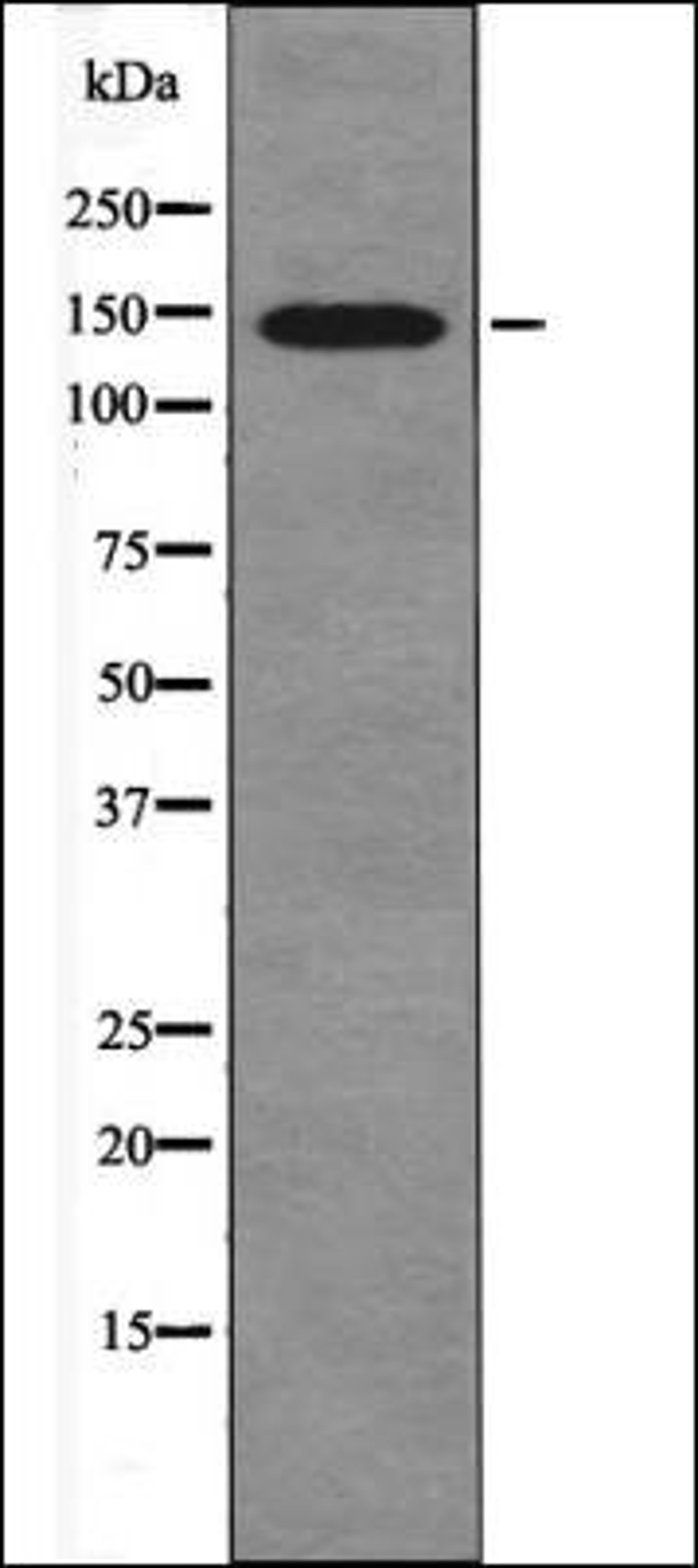 Western blot analysis of UV treated HeLa whole cell lysates using eNOS -Phospho-Ser1179- antibody