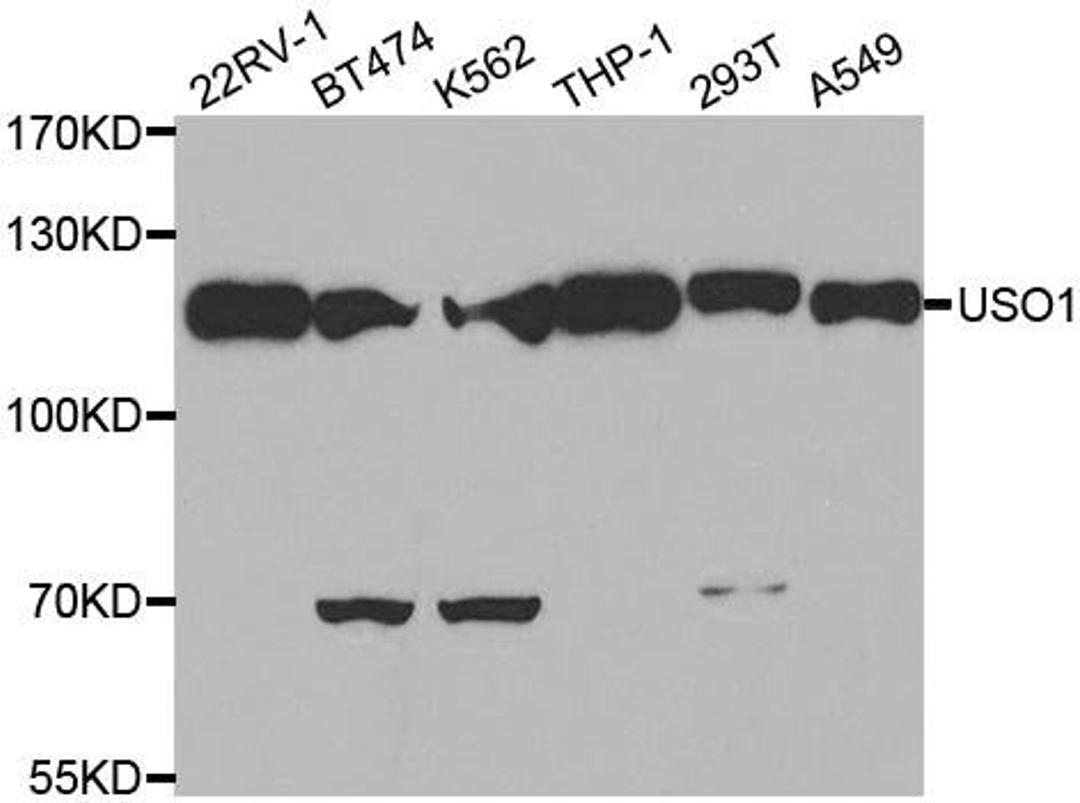 Western blot analysis of extracts of various cell lines using USO1 antibody