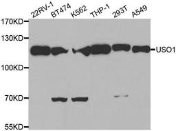 Western blot analysis of extracts of various cell lines using USO1 antibody