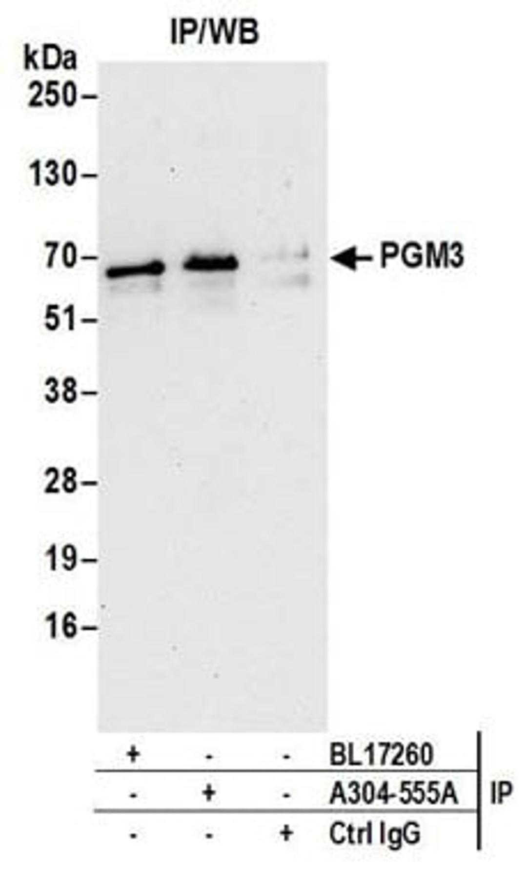 Detection of human PGM3 by western blot of immunoprecipitates.