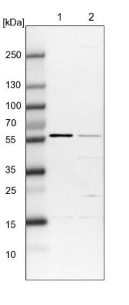 Western Blot: Phenylalanine Hydroxylase Antibody [NBP1-80917] - Lane 1: NIH-3T3 cell lysate (Mouse embryonic fibroblast cells)<br/>Lane 2: NBT-II cell lysate (Rat Wistar bladder tumour cells)