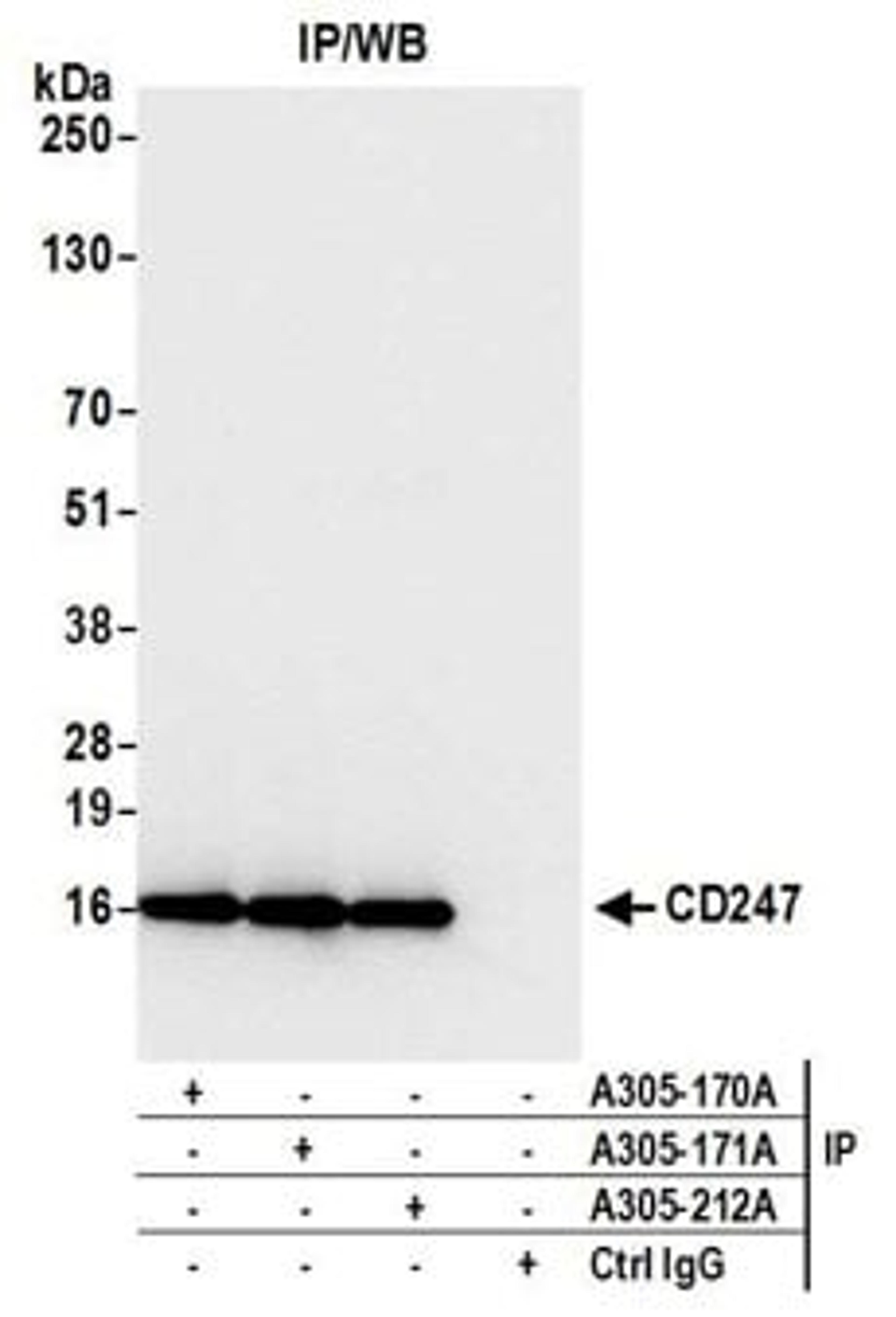 Detection of human CD247 by western blot of immunoprecipitates.