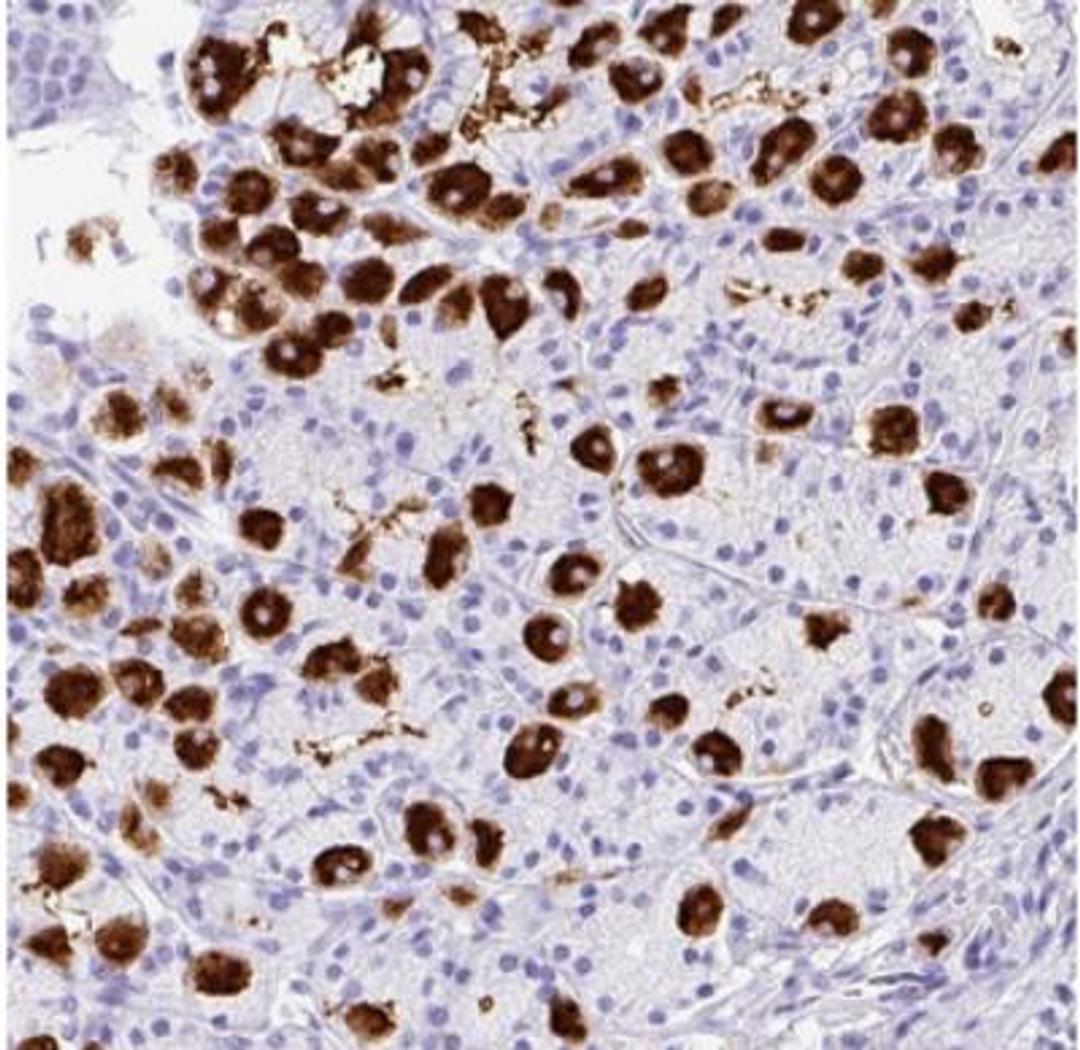 Immunohistochemistry: MUC21 Antibody [NBP2-31023] - Human stomach.