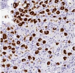 Immunohistochemistry: MUC21 Antibody [NBP2-31023] - Human stomach.