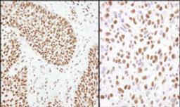 Detection of human and mouse Matrin 3 by immunohistochemistry.