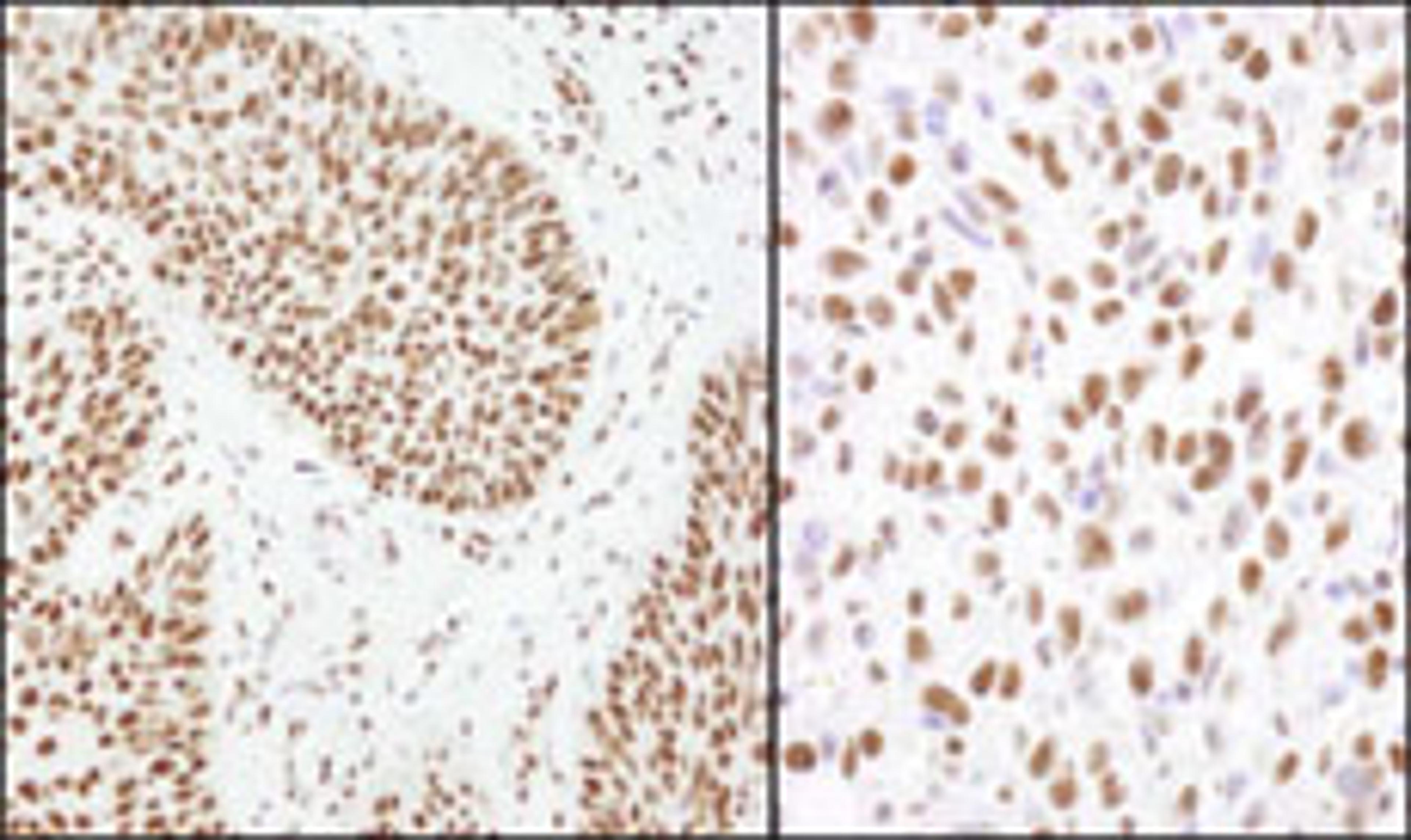 Detection of human and mouse Matrin 3 by immunohistochemistry.