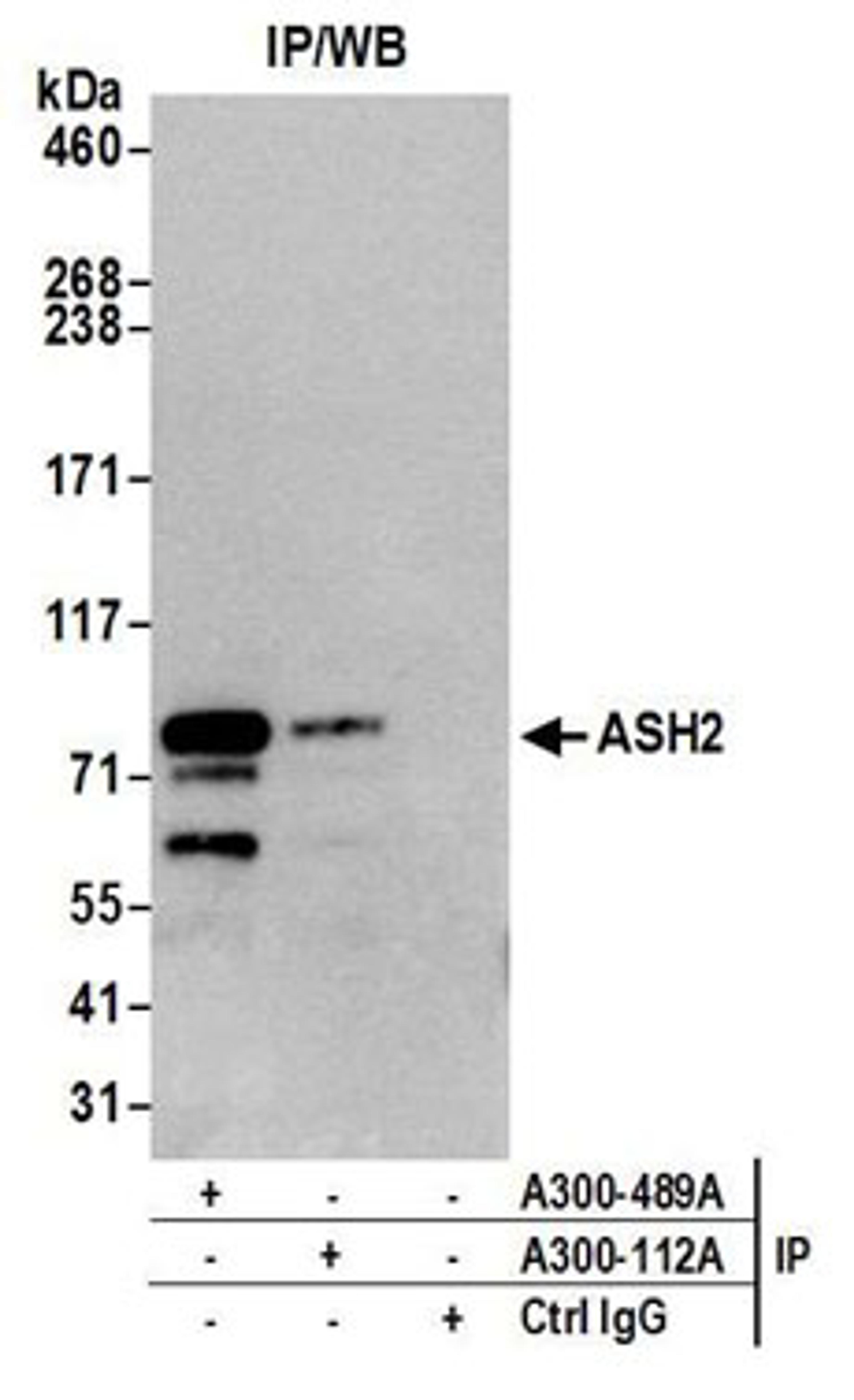 Detection of human ASH2 by western blot of immunoprecipitates.