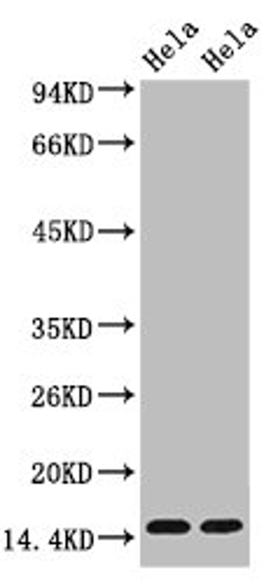 Western blot analysis of Hela, diluted at  1) 1:1000  2) 1:5000