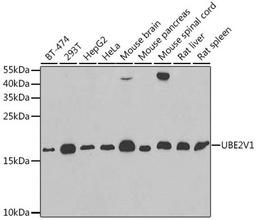 Western blot - UBE2V1 antibody (A6316)