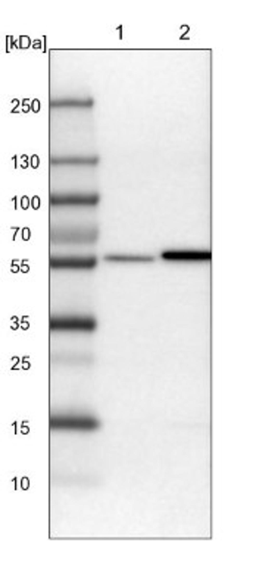 Western Blot: ALDH8A1 Antibody [NBP1-89151] - Lane 1: Mouse liver tissue lysate<br/>Lane 2: Rat liver tissue lysate