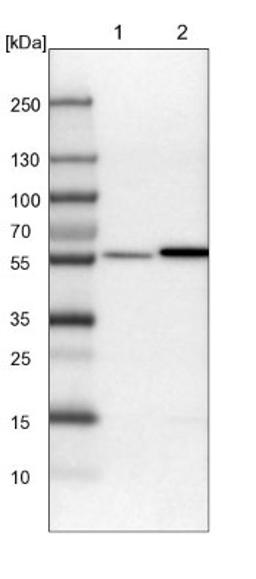 Western Blot: ALDH8A1 Antibody [NBP1-89151] - Lane 1: Mouse liver tissue lysate<br/>Lane 2: Rat liver tissue lysate