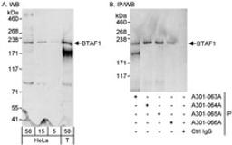 Detection of human BTAF1 by western blot and immunoprecipitation.