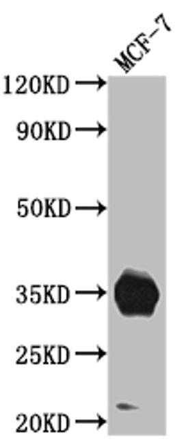 Western Blot. Positive WB detected in: MCF-7 whole cell lysate. All lanes: IGFBP2 antibody at 1:1000. Secondary. Goat polyclonal to rabbit IgG at 1/50000 dilution. Predicted band size: 35 kDa. Observed band size: 35 kDa. 