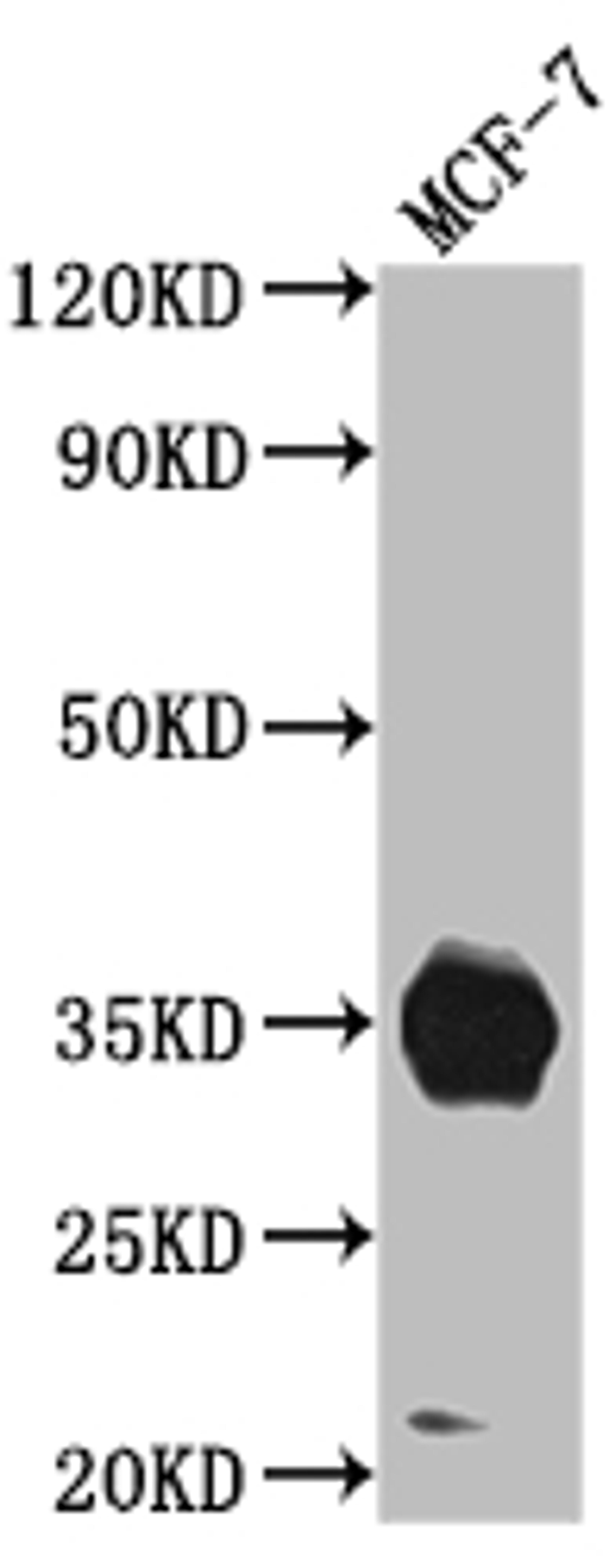 Western Blot. Positive WB detected in: MCF-7 whole cell lysate. All lanes: IGFBP2 antibody at 1:1000. Secondary. Goat polyclonal to rabbit IgG at 1/50000 dilution. Predicted band size: 35 kDa. Observed band size: 35 kDa. 