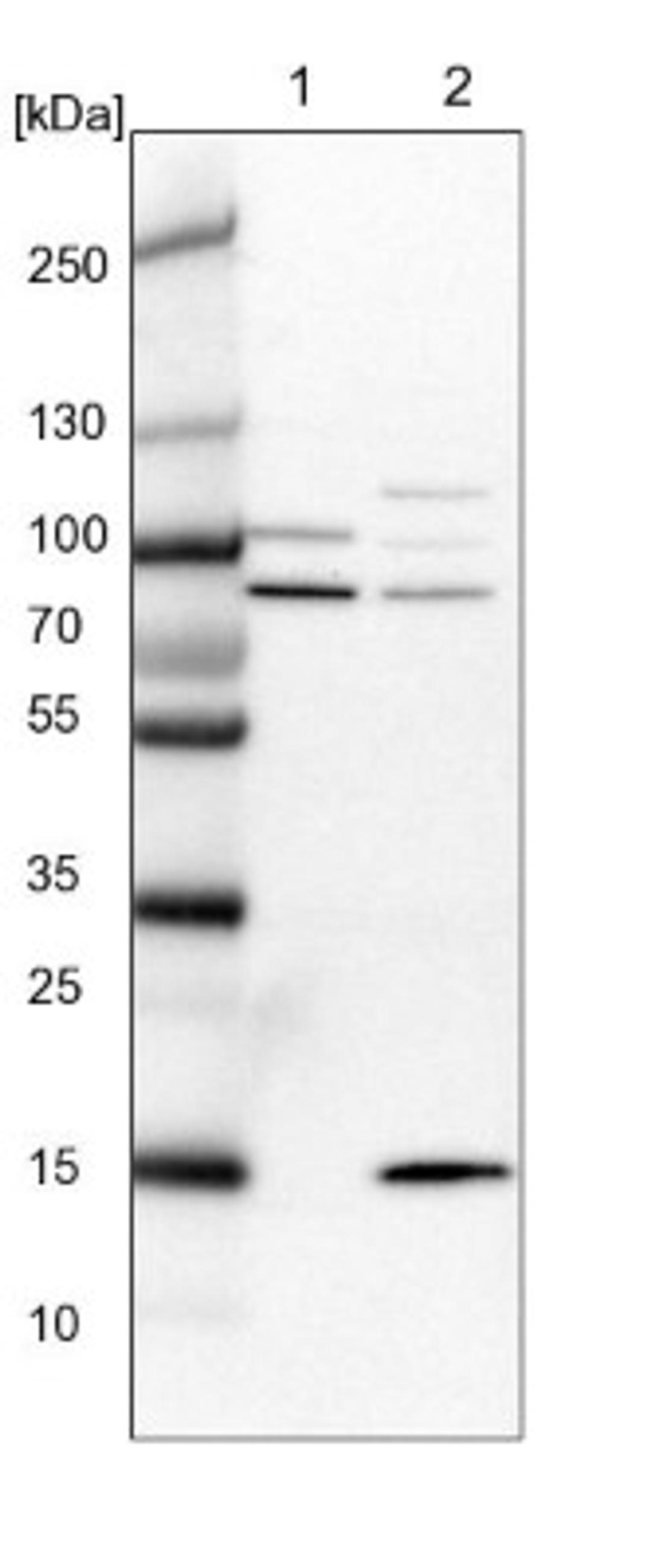 Western Blot: SRBD1 Antibody [NBP1-84630] - Lane 1: NIH-3T3 cell lysate (Mouse embryonic fibroblast cells)<br/>Lane 2: NBT-II cell lysate (Rat Wistar bladder tumour cells)