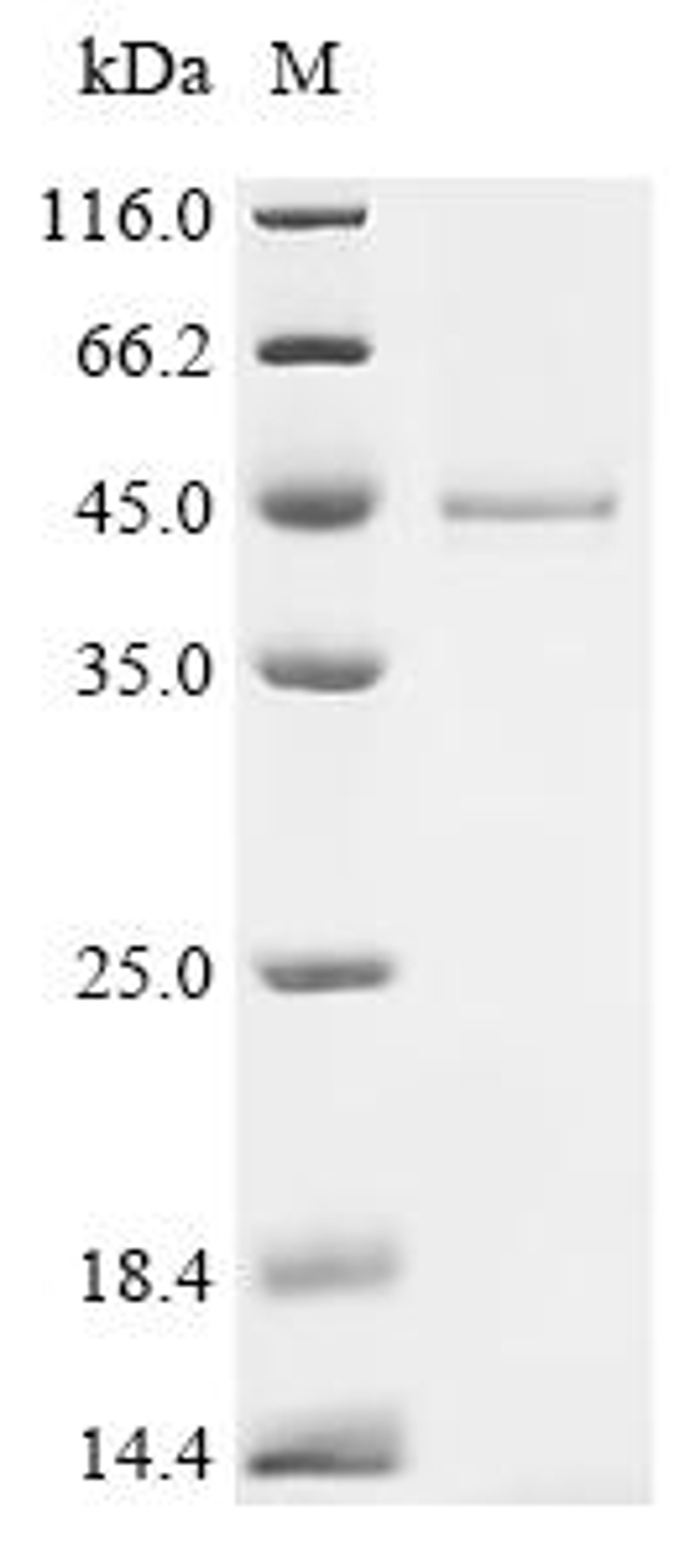 (Tris-Glycine gel) Discontinuous SDS-PAGE (reduced) with 5% enrichment gel and 15% separation gel.