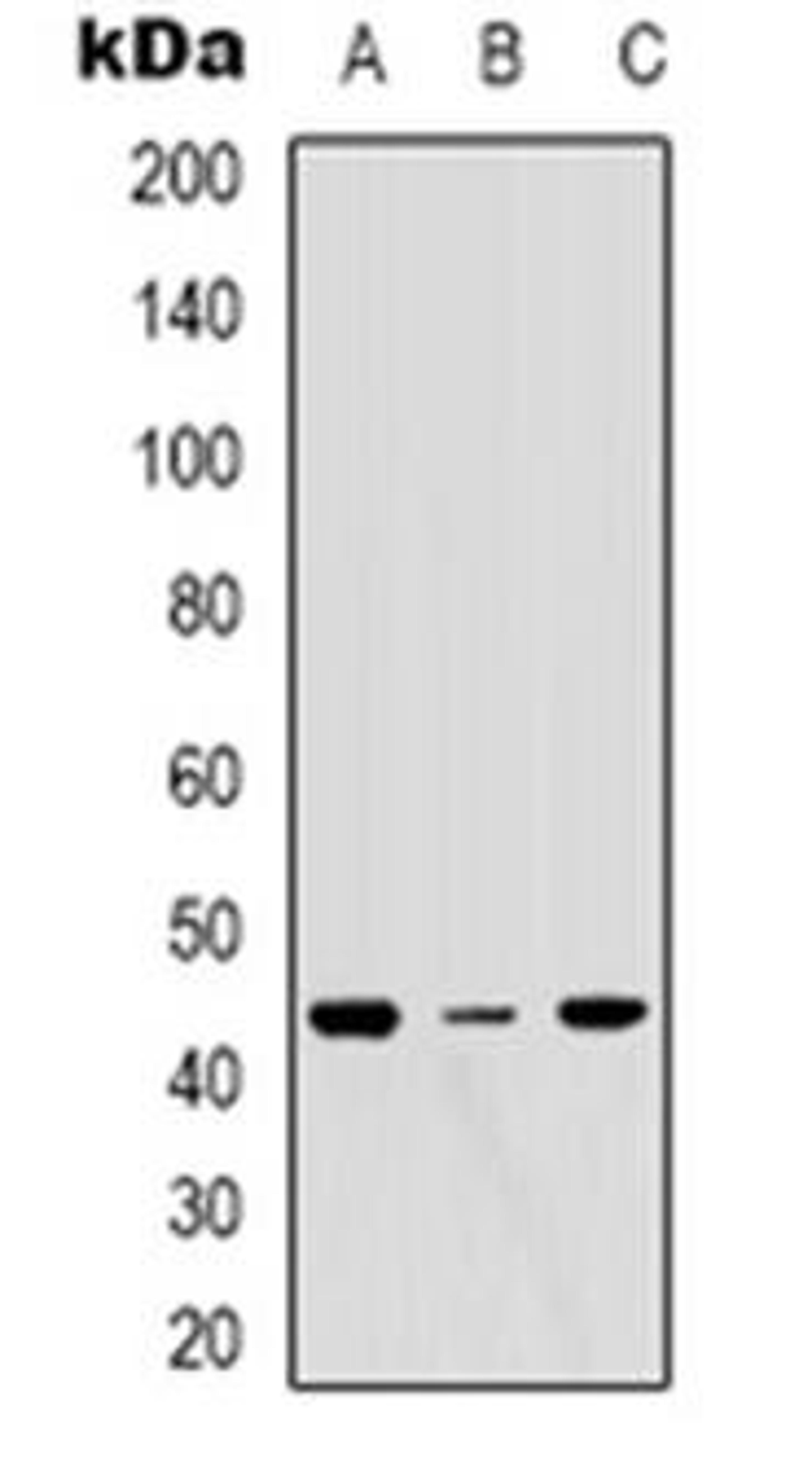 Western blot analysis of ERGIC3 expression in MCF7 (Lane 1), Hela (Lane 2), NIH3T3 (Lane 3) whole cell lysates using ERGIC3 antibody