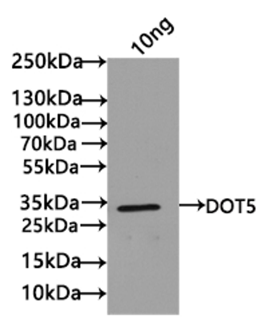 Western Blot. Positive WB detected in: recombinant protein. All lanes: DOT5 Antibody at 1:1000. Secondary. Goat polyclonal to rabbit IgG at 1/50000 dilution. Predicted band size: 25 kDa. Observed band size: 25 kDa.