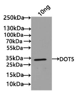 Western Blot. Positive WB detected in: recombinant protein. All lanes: DOT5 Antibody at 1:1000. Secondary. Goat polyclonal to rabbit IgG at 1/50000 dilution. Predicted band size: 25 kDa. Observed band size: 25 kDa.