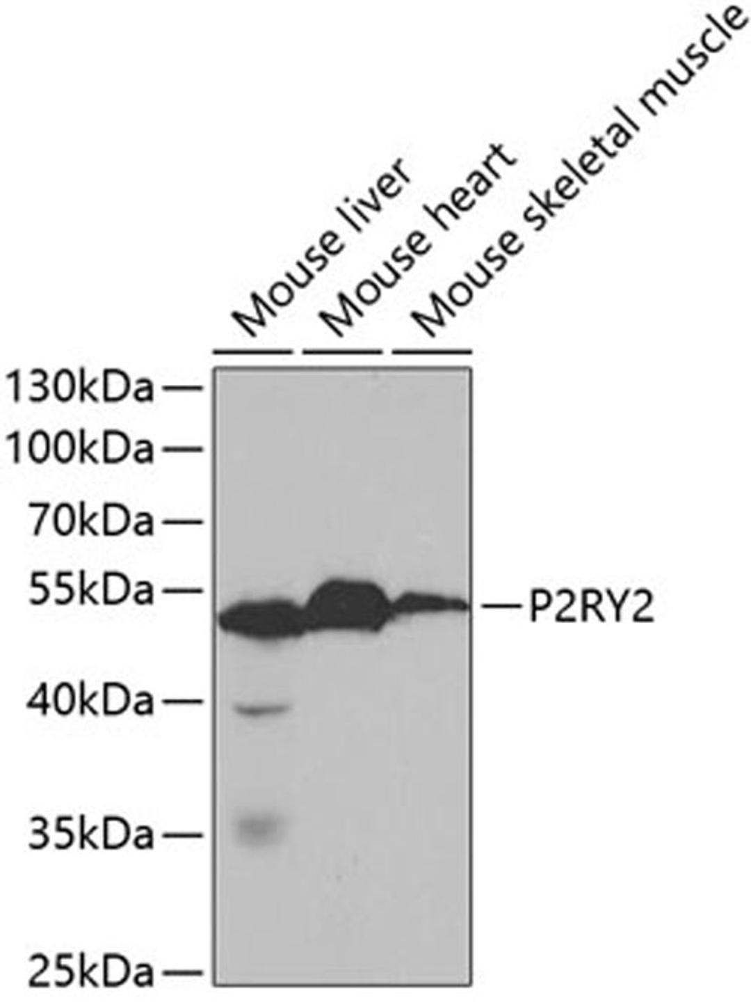 Western blot - P2RY2 antibody (A5779)