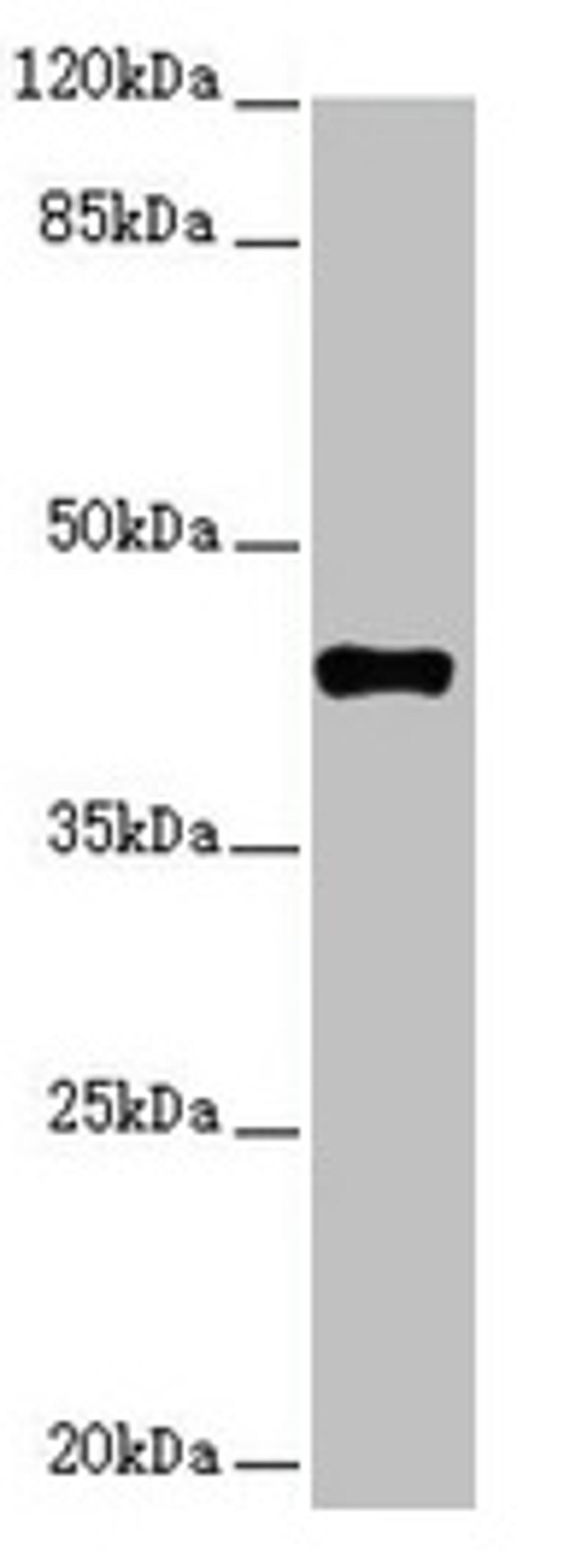 Western blot. All lanes: SH3GL1 antibody at 2.48µg/ml + HT29 whole cell lysate. Secondary. Goat polyclonal to rabbit IgG at 1/10000 dilution. Predicted band size: 42, 37, 35 kDa. Observed band size: 42 kDa