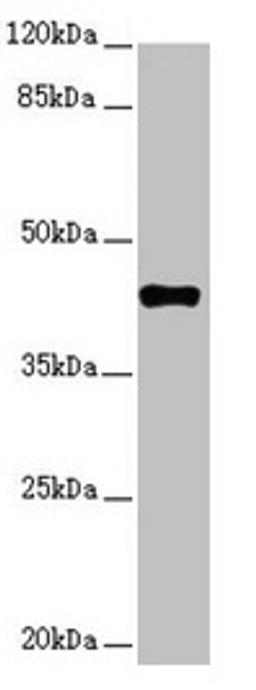 Western blot. All lanes: SH3GL1 antibody at 2.48µg/ml + HT29 whole cell lysate. Secondary. Goat polyclonal to rabbit IgG at 1/10000 dilution. Predicted band size: 42, 37, 35 kDa. Observed band size: 42 kDa