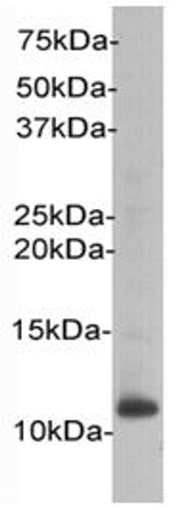 Western Blot analysis of HL-60 using beta 2 Microglobulin antibody