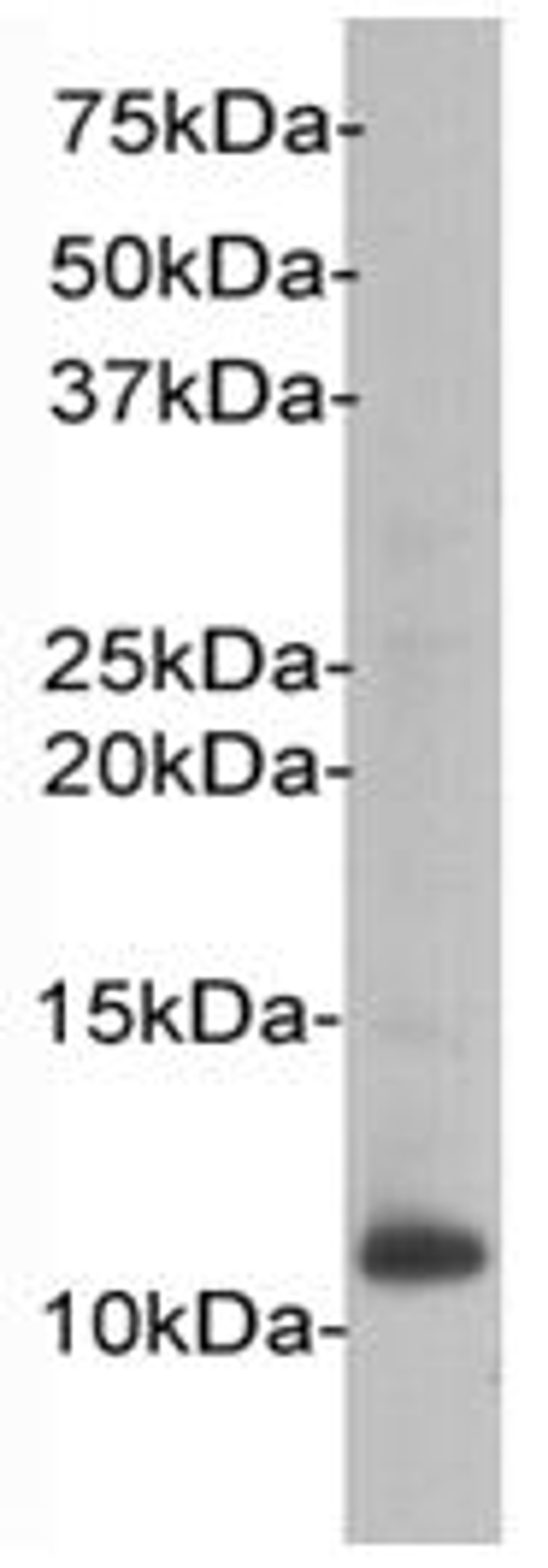 Western Blot analysis of HL-60 using beta 2 Microglobulin antibody